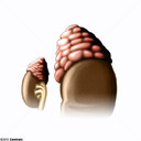 Supra-renal