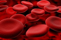Anemia hemolítica - conceito, causas, sintomas, diagnóstico e tratamento