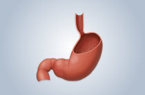 Câncer de estômago: o que é? Quais os fatores de risco? Como são os sintomas? E o diagnóstico e o tratamento? O que fazer para evitar? Câncer de estômago: o que é? Quais os fatores de risco? Como são os sintomas? E o diagnóstico e o tratamento? O que fazer para evitar?