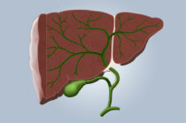 Câncer de fígado: causas, sintomas, diagnóstico, tratamento, evolução e prevenção