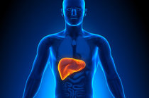 Como é o carcinoma hepatocelular?