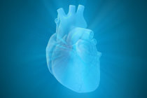 Choque cardiogênico Choque cardiogênico