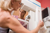 Como é feita a mamografia? Por que é aconselhada?