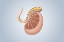 Criptorquidia: o que fazer quando o testículo não está na bolsa escrotal?
