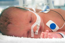 Entendendo a prematuridade e os cuidados necessários com os prematuros Entendendo a prematuridade e os cuidados necessários com os prematuros