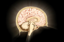 Hipertens&atilde;o intracraniana idiop&aacute;tica