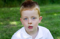 Impetigo: conceito, causas, sintomas, diagn&oacute;stico, tratamento, evolu&ccedil;&atilde;o, preven&ccedil;&atilde;o, complica&ccedil;&otilde;es poss&iacute;veis