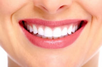 Implante dentário: o que é? Quando fazer? Quem pode fazer? Como é feito? Quais são as vantagens?