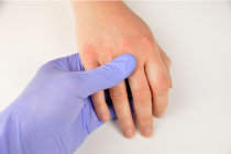 Patologias dos dedos das mãos e dos pés
