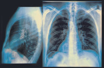 Radiografia contrastada: o que é? Por que fazer? Como é feita?