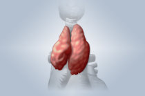 Timoma: conceito, causas, fisiopatologia, sintomas, diagnóstico, tratamento, prevenção, possíveis complicações