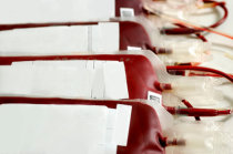 Transfusão de sangue: o que é? Como ela é feita? Quando ela deve ser feita? Existe alguma complicação possível?