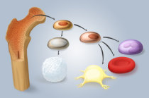 Transplante de medula óssea: o que é? Quem deve fazer? Em que consiste? Quais são as possíveis complicações?