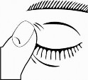 Cloridrato de Dorzolamida + Maleato de Timolol (Solução oftálmica 2% + 0,5%)