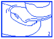 DERMOCERYL
