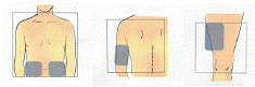 Fuzeon® (enfuvirtida)